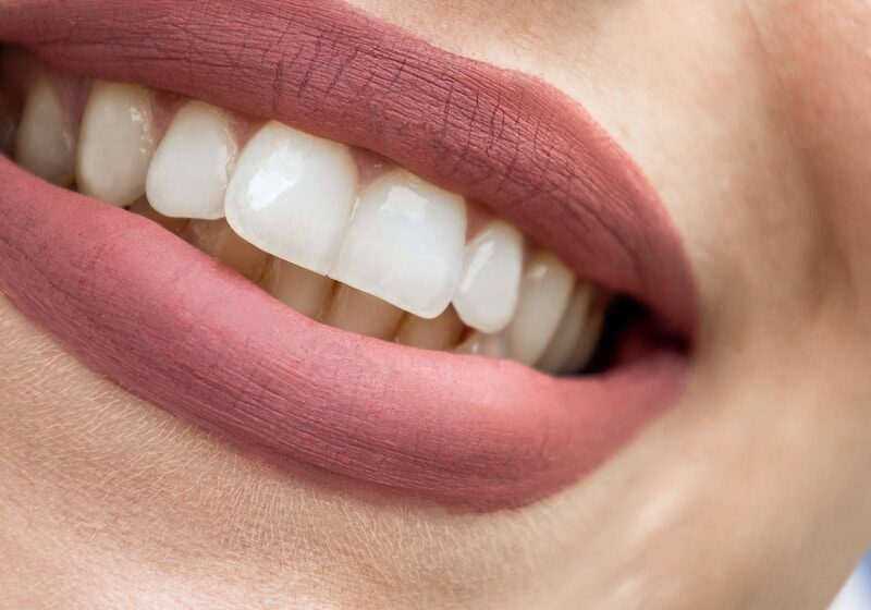 epm-kosmetik-lohnherstellung-a close up of a woman's mouth with white teeth
